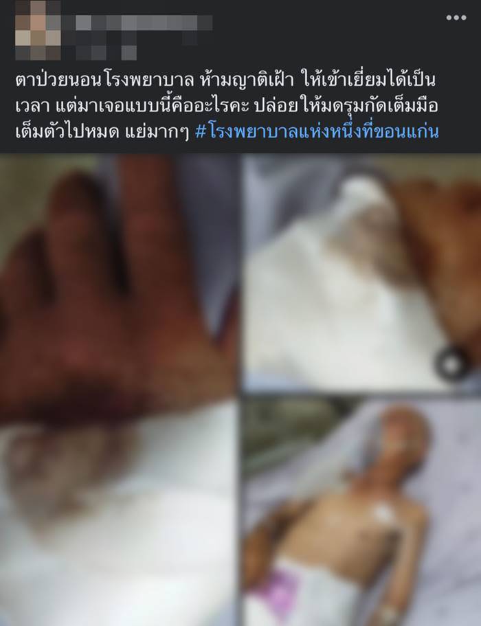 โวยโรงพยาบาล มดกัดแผลคนไข้