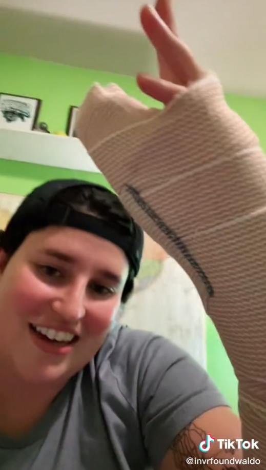 มะเร็งใต้เล็บ