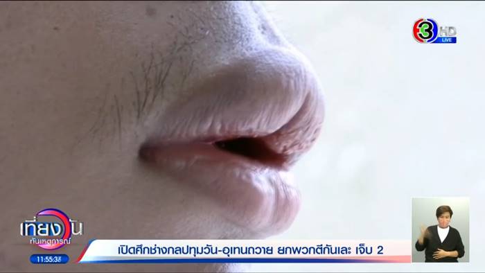 ช่างกลตีกัน ไรเดอร์ถูกลูกหลง