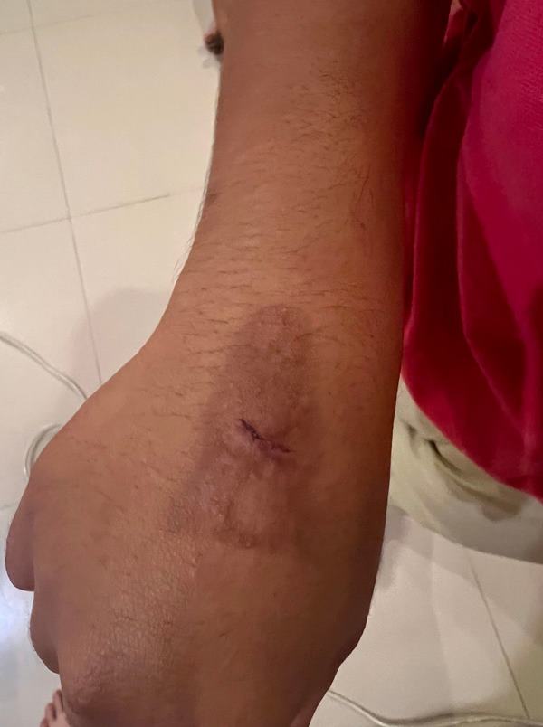 ข่าวเมียสว. ทำร้ายทหารหญิง