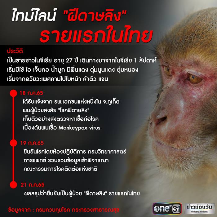 ฝีดาษลิง