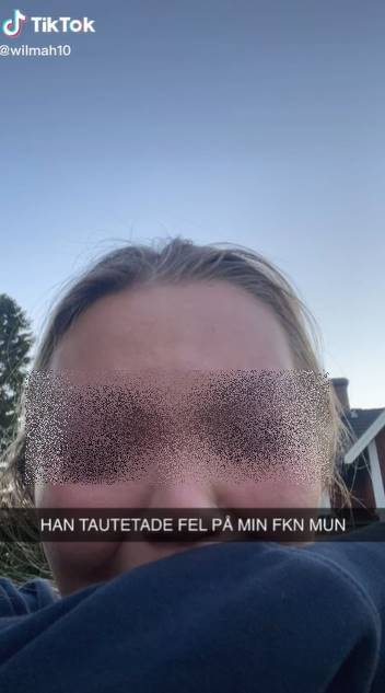 สักลายที่ริมฝีปาก