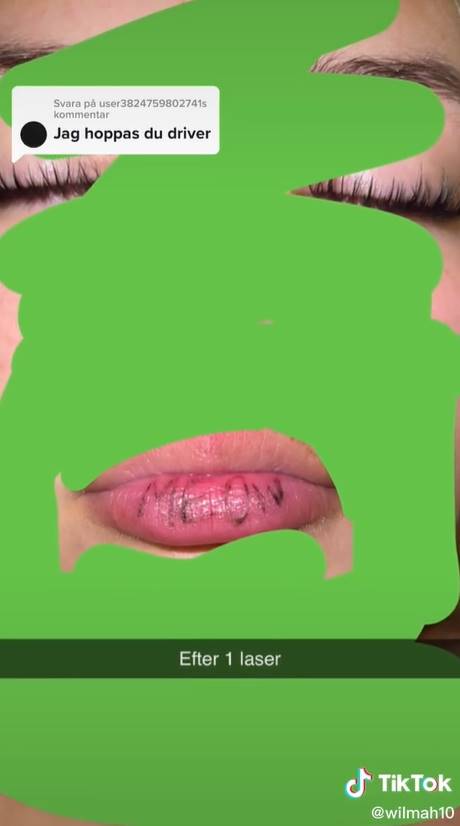 สักลายที่ริมฝีปาก