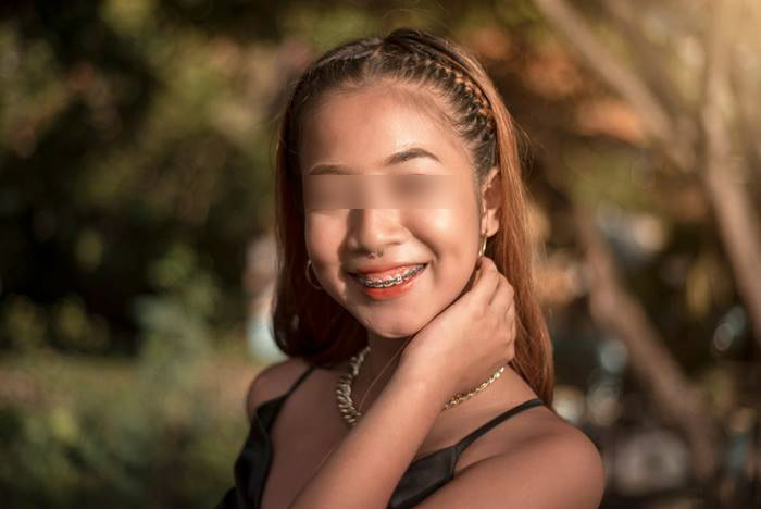 ทรงซ้อ คืออะไร 