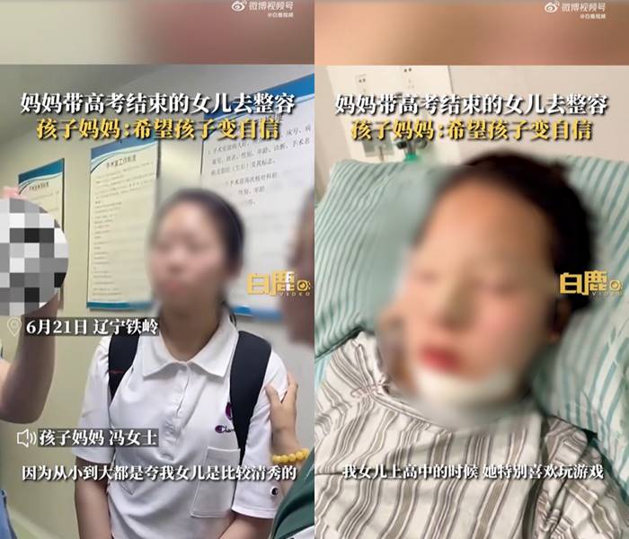 แม่พาลูกไปทำ ศัลยกรรมหน้า