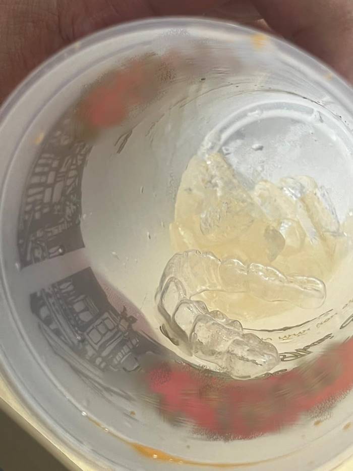 ที่จัดฟันในแก้วชาร้านดัง