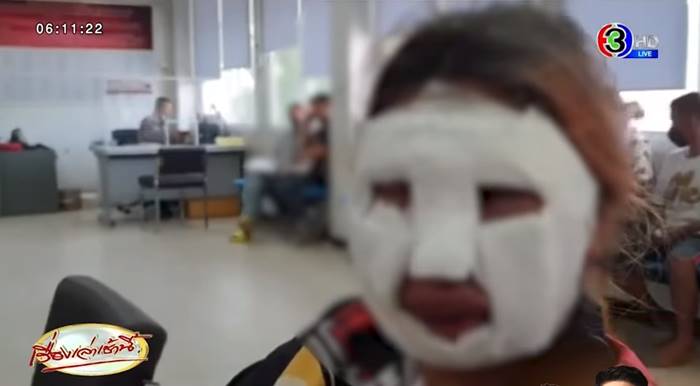 สาวท้องขายเฟรนช์ฟรายส์ น้ำมันลวกหน้า