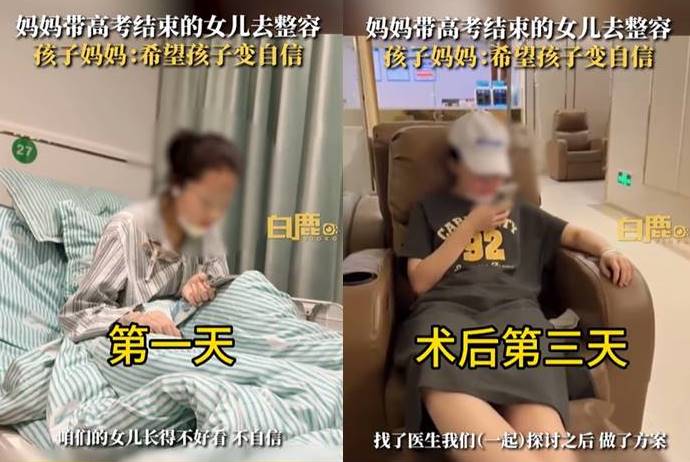 แม่พาลูกไปทำ ศัลยกรรมหน้า