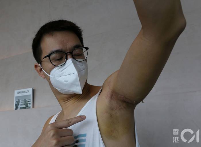 หนุ่มฮ่องกง กระโดดบันจี้จั๊มพ์ในไทย เชือกขาด ชดเชย 10000