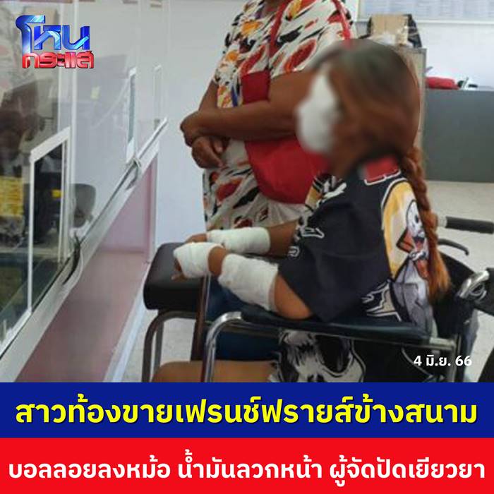 สาวท้องขายเฟรนช์ฟรายส์ น้ำมันลวกหน้า