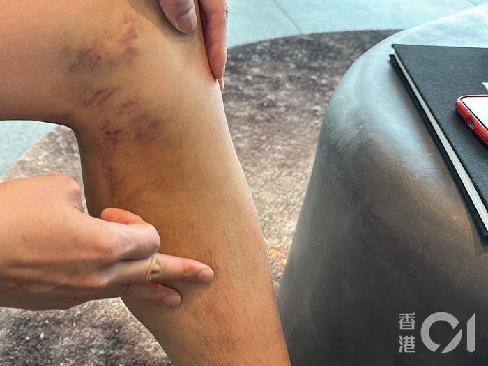 หนุ่มฮ่องกง กระโดดบันจี้จั๊มพ์ในไทย เชือกขาด ชดเชย 10000