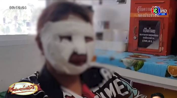 สาวท้องขายเฟรนช์ฟรายส์ น้ำมันลวกหน้า