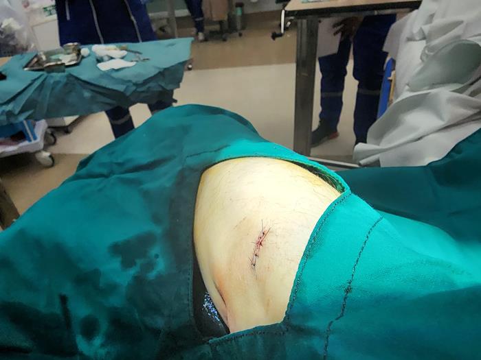 สาวโดนแทงในห้าง