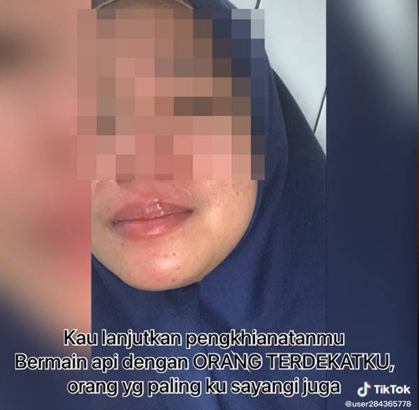 เจ้าสาวฟ้องหย่าหลังแต่ง 3 วัน สามีแอบกินตับกับแม่ยาย