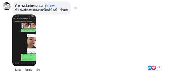 แพ้ฟิลเลอร์