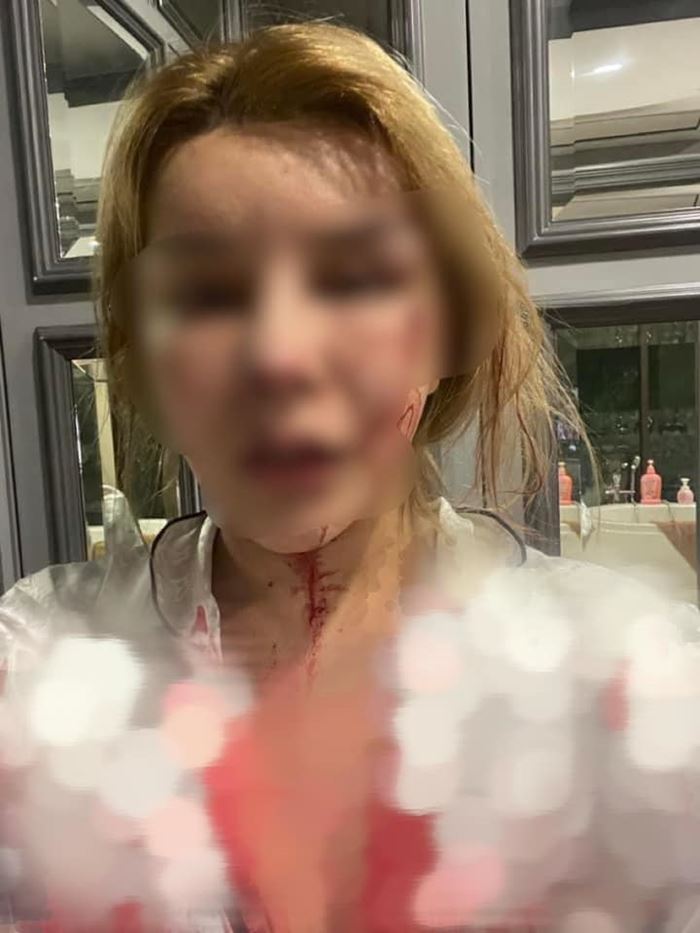 เมียแฉ ผัวตำรวจทำร้ายร่างกาย