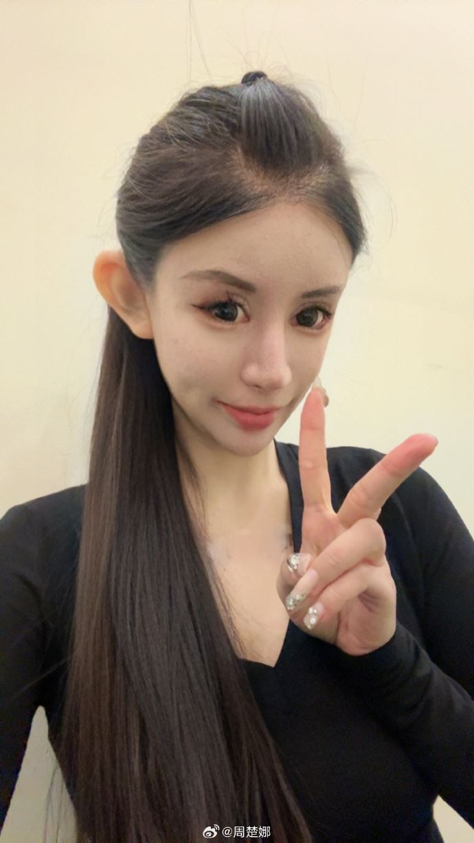 เสพติดศัลยกรรม