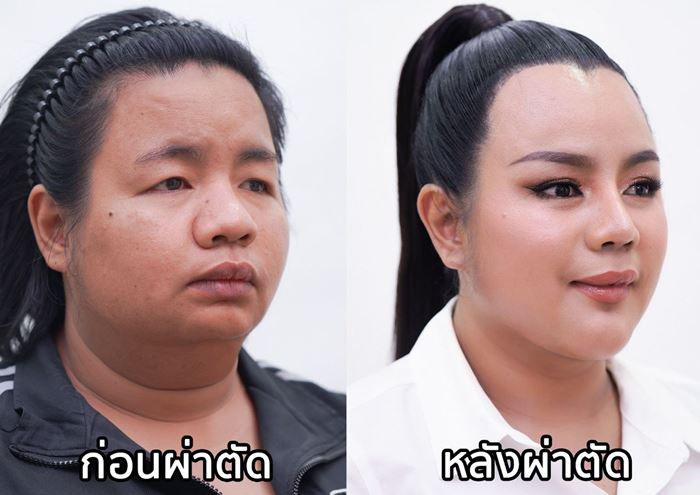ทหารหญิงรับใช้ ศัลยกรรมหน้าใหม่