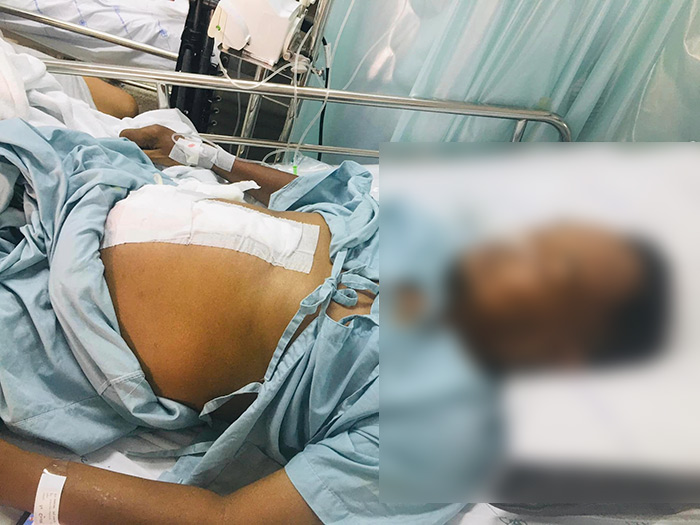 หมอวินิจฉัยผิด ผ่าตัดฟรี