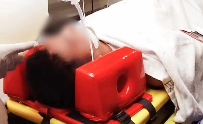 งูจงอางกัด