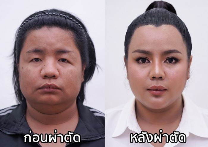 ทหารหญิงรับใช้ ศัลยกรรมหน้าใหม่