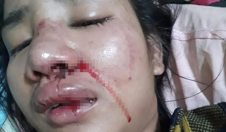 ทำร้ายผู้หญิง