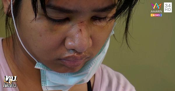 ทำร้ายผู้หญิง