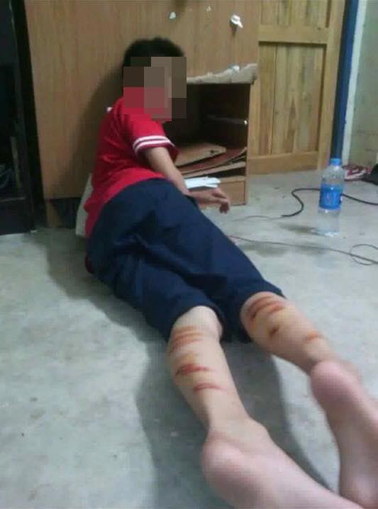 ครูตีนักเรียน