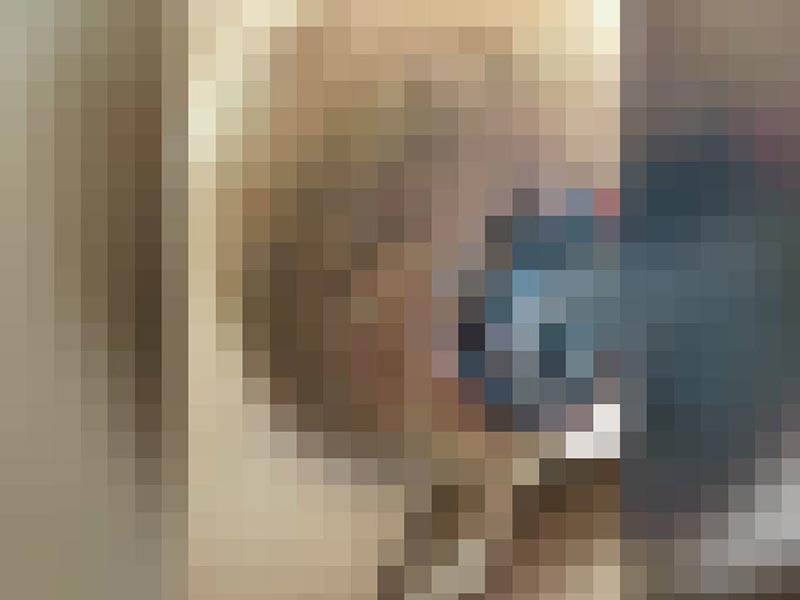 ศัลยกรรมหน้าอก