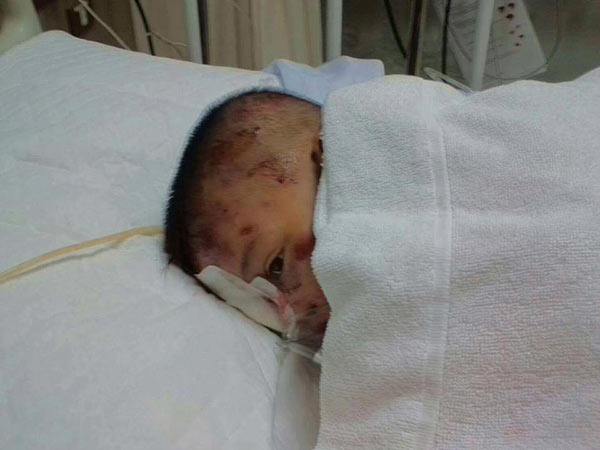 สุนัขกัดคน