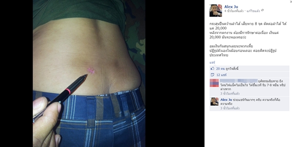  กปปส. แฉกันเอง !? โกงเงินบริจาค ทอดทิ้งผู้บาดเจ็บ