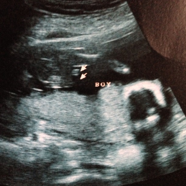 ตั๊ก บงกช