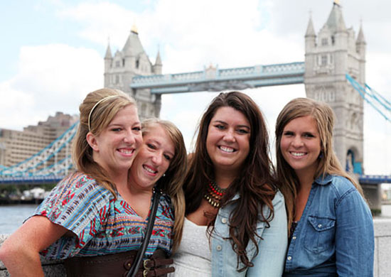  แฝดสาวตัวติดกัน เผยเคล็ดลับใช้ชีวิตด้วยความเข้าใจ