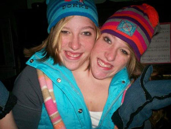  แฝดสาวตัวติดกัน เผยเคล็ดลับใช้ชีวิตด้วยความเข้าใจ