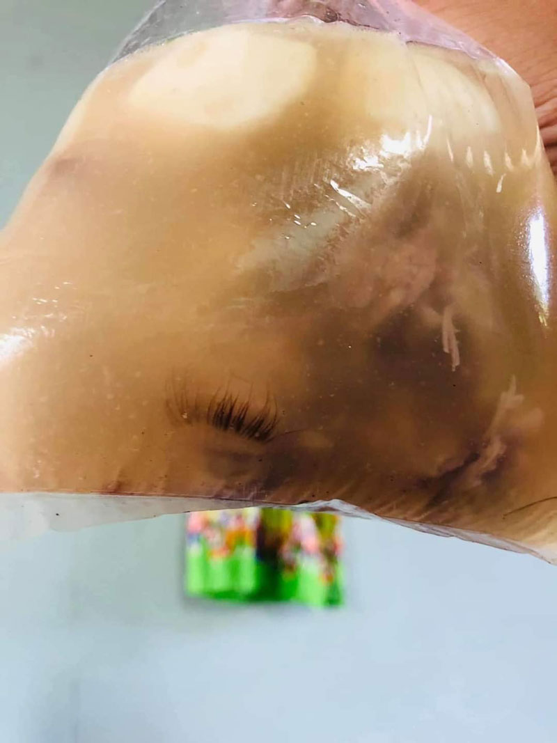 ขนตาอะไร