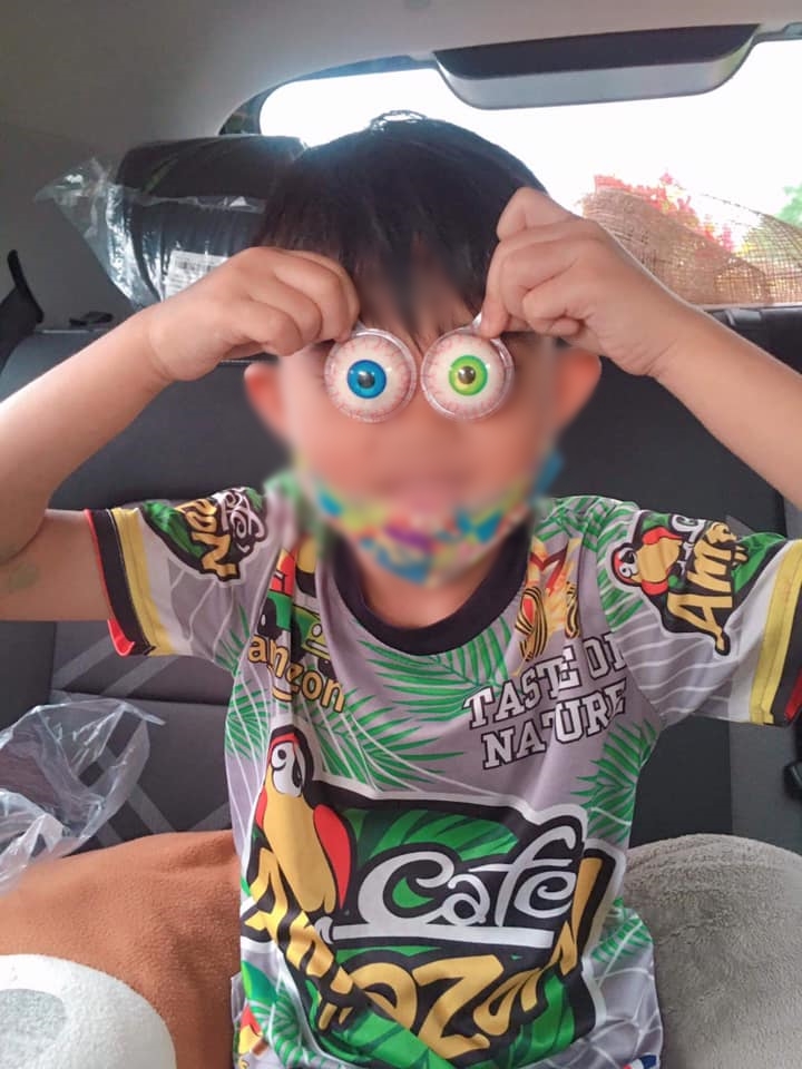 เยลลี่ลูกตา