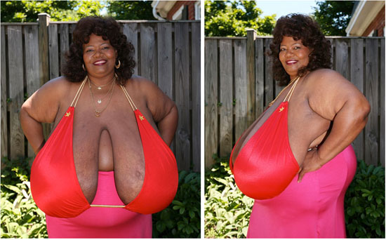 หญิงมะกันอกตู้มสุดในโลก ข้างละเกือบ 20 กก.