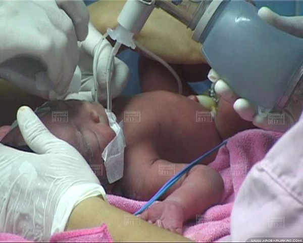 สุนัขฮีโร่พันธุ์ทาง ช่วยชีวิตทารกแรกคลอด ถูกทิ้งถังขยะ