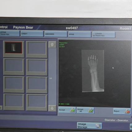  ชายมะกันเจอหมีเจ็บ อุ้มพาขึ้นรถกว่า 1 ชม. ไปโรงพยาบาล