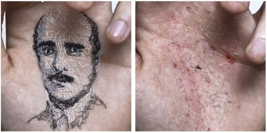 ศิลปินชาวสเปน ปักเย็บภาพเหมือนของครอบครัวบนฝ่ามือตัวเอง 