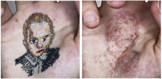 ศิลปินชาวสเปน ปักเย็บภาพเหมือนของครอบครัวบนฝ่ามือตัวเอง 