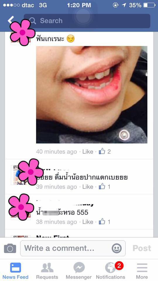 แฉแม่ค้าขายคอนแทคเลนส์