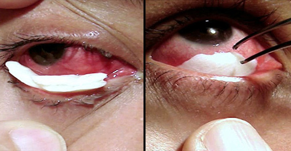 น้ำตาคริสตัล