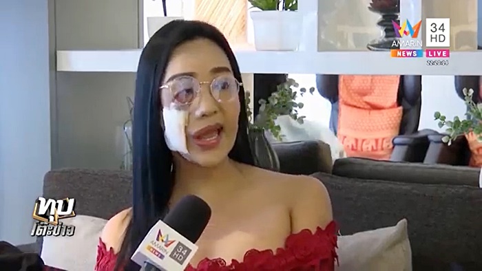 ศัลยกรรมหน้าพัง