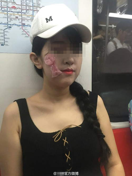 ถุงยางอนามัยแปะหน้า