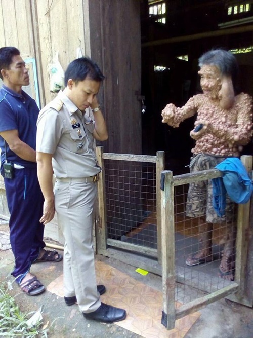 ท้าวแสนปม