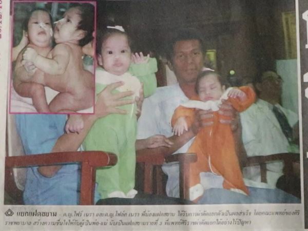 น้องไฟว์-น้องโฟร์ท แฝดสยาม