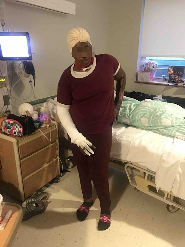 เผาตัวเอง