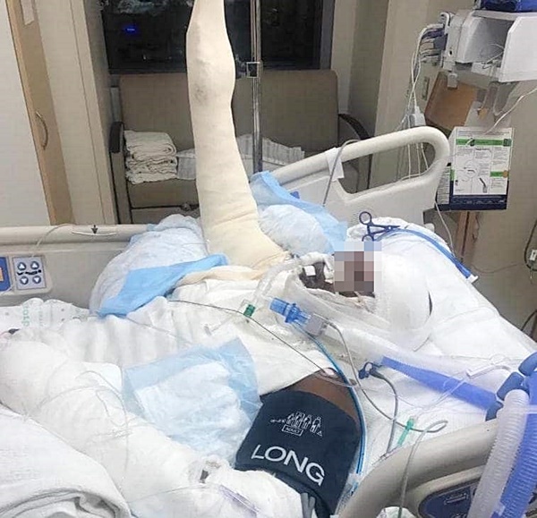 เผาตัวเอง