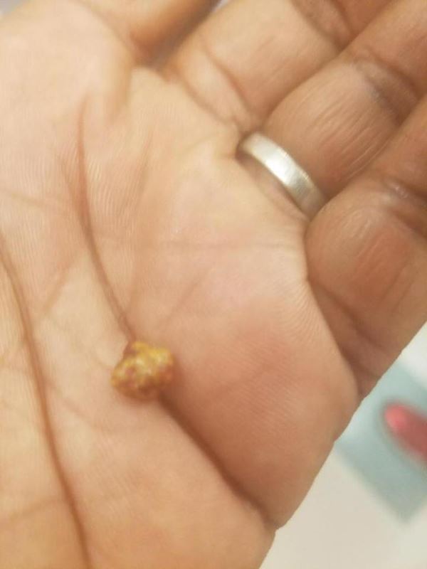 พี่เลี้ยงในศูนย์เด็กเล็ก